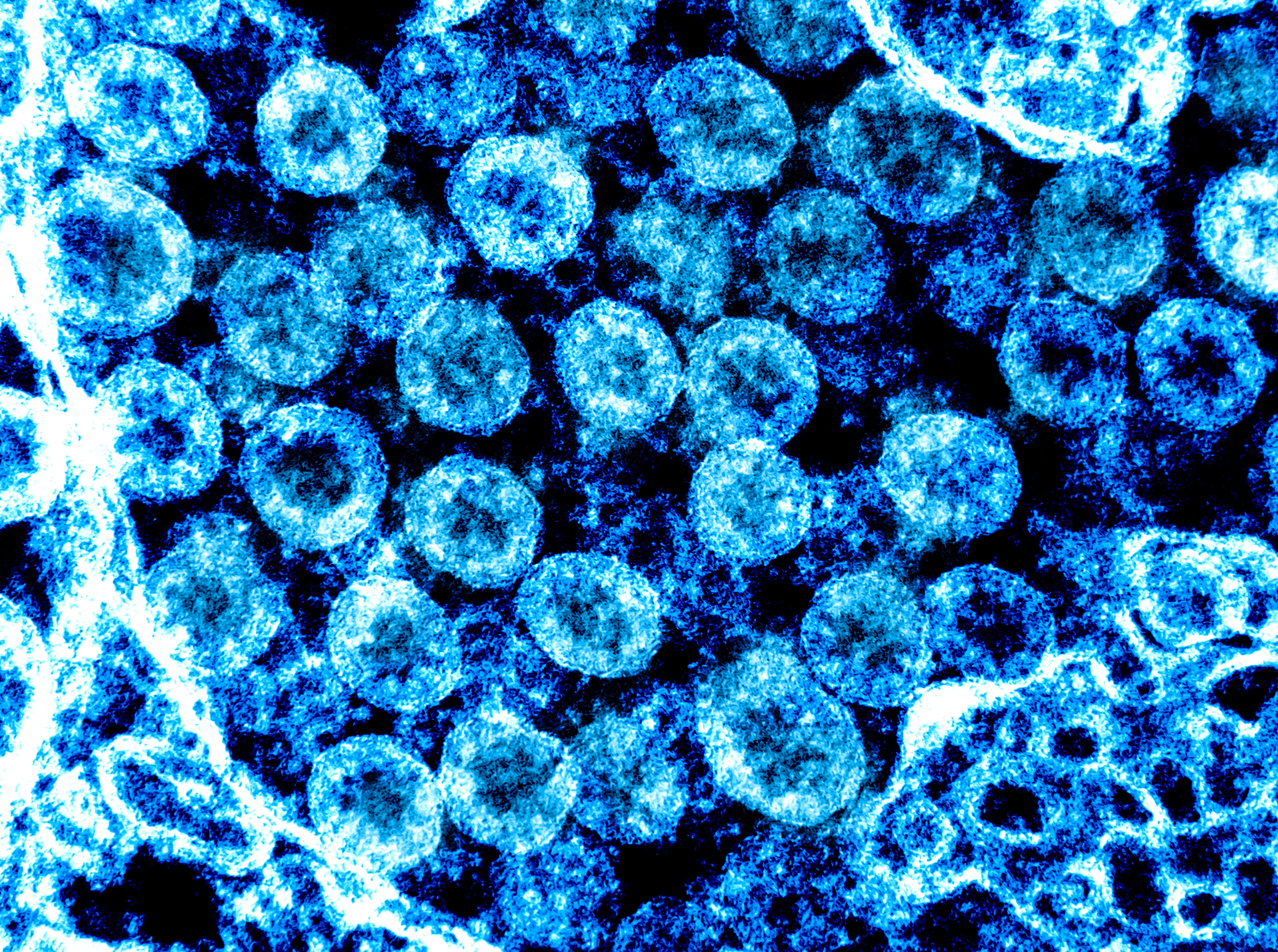 La IA crea los primeros virus sintéticos
