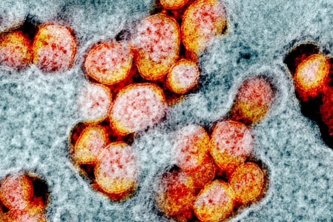 Micrografía electrónica de transmisión del coronavirus SARS-CoV-2 en una muestra aislada de un paciente infectado tomada por el Instituto Nacional de Alergias y Enfermedades Infecciosas ((NIAID) de Maryland, Washington, EEUU.