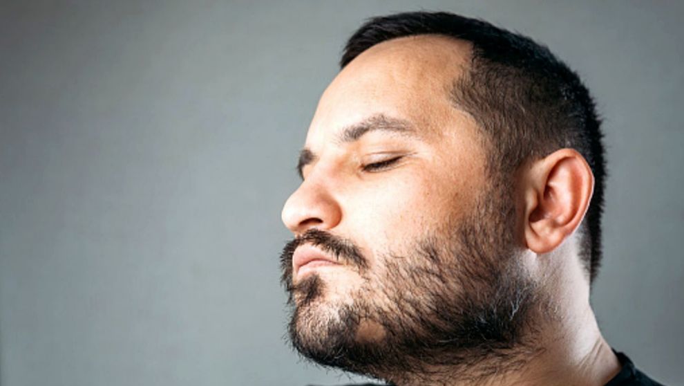 Calvas la barba: causas y expertos para la alopecia areta |