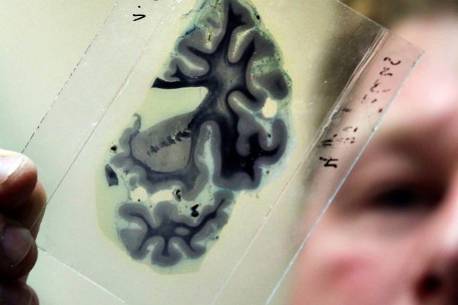 Un investigador mira una muestra microscópica de un cerebro humano en el laboratorio de enfermedades neurodegenerativas en la Universidad de Rostock,  Alemania, en una imagen de archivo.