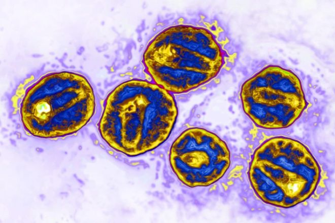 En la imagen, las partículas de VIH (en la foto) usan un receptor llamado CCR5 para infectar células humanas. Una mutación particular en este receptor hace que las células sean resistentes al virus.