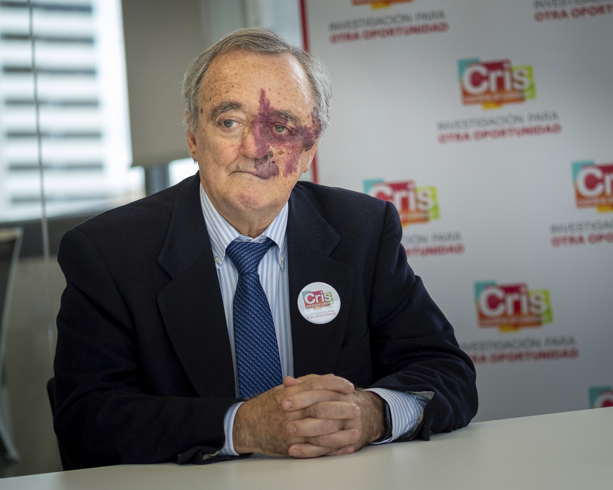 La revista PNAS revalida el estudio del cáncer de páncreas en ratones liderado por Mariano Barbacid